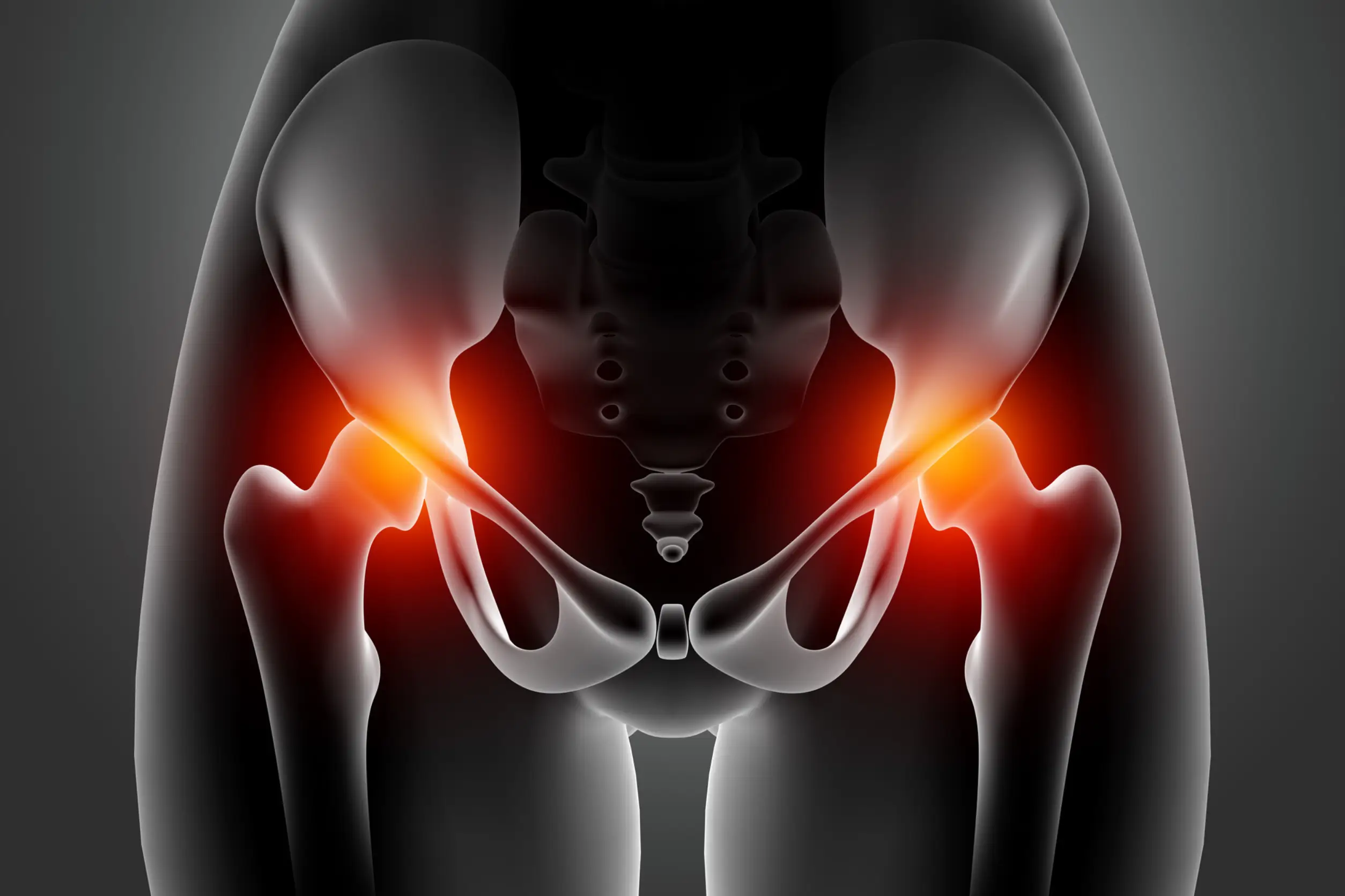 Sciatica Acupuncture